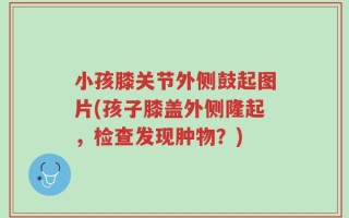 小孩膝关节外侧鼓起图片(孩子膝盖外侧隆起，检查发现肿物？)