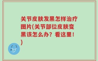 关节皮肤发黑怎样治疗图片(关节部位皮肤变黑该怎么办？看这里！)