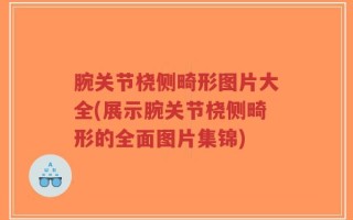 腕关节桡侧畸形图片大全(展示腕关节桡侧畸形的全面图片集锦)