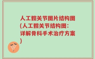 人工髋关节图片结构图(人工髋关节结构图：详解骨科手术治疗方案)