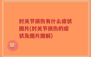 肘关节损伤有什么症状图片(肘关节损伤的症状及图片图解)