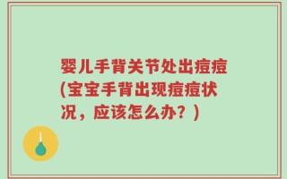 婴儿手背关节处出痘痘(宝宝手背出现痘痘状况，应该怎么办？)