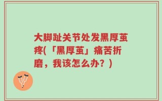 大脚趾关节处发黑厚茧疼(「黑厚茧」痛苦折磨，我该怎么办？)
