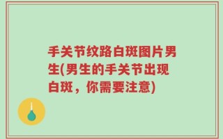 手关节纹路白斑图片男生(男生的手关节出现白斑，你需要注意)