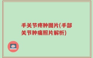 手关节疼肿图片(手部关节肿痛照片解析)
