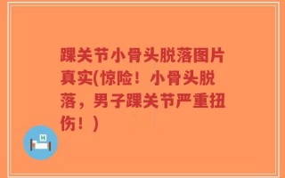 踝关节小骨头脱落图片真实(惊险！小骨头脱落，男子踝关节严重扭伤！)