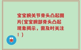 宝宝腕关节骨头凸起图片(宝宝腕部骨头凸起现象揭示，需及时关注！)