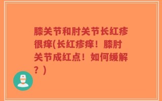 膝关节和肘关节长红疹很痒(长红疹痒！膝肘关节成红点！如何缓解？)