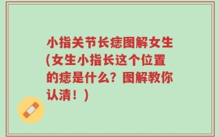 小指关节长痣图解女生(女生小指长这个位置的痣是什么？图解教你认清！)