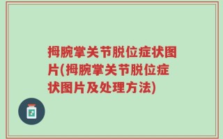 拇腕掌关节脱位症状图片(拇腕掌关节脱位症状图片及处理方法)