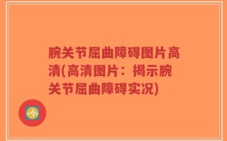 腕关节屈曲障碍图片高清(高清图片：揭示腕关节屈曲障碍实况)