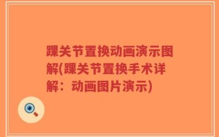 踝关节置换动画演示图解(踝关节置换手术详解：动画图片演示)