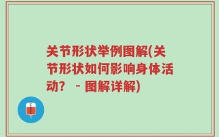 关节形状举例图解(关节形状如何影响身体活动？ - 图解详解)
