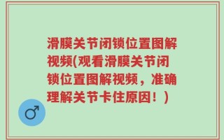 滑膜关节闭锁位置图解视频(观看滑膜关节闭锁位置图解视频，准确理解关节卡住原因！)