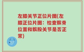 左膝关节正位片图(左膝正位片图：检查髌骨位置和髌股关节是否正常)