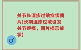 关节长湿疹过敏症状图片(长期湿疹过敏引发关节疼痛，图片揭示症状)