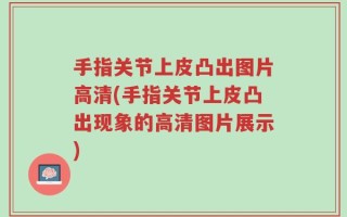 手指关节上皮凸出图片高清(手指关节上皮凸出现象的高清图片展示)