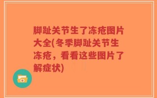 脚趾关节生了冻疮图片大全(冬季脚趾关节生冻疮，看看这些图片了解症状)