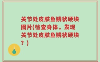 关节处皮肤鱼鳞状硬块图片(检查身体，发现关节处皮肤鱼鳞状硬块？)