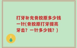 打牙补充骨胶原多少钱一针(骨胶原打牙提亮牙齿？一针多少钱？)