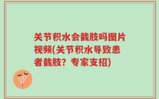 关节积水会截肢吗图片视频(关节积水导致患者截肢？专家支招)