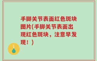手脚关节表面红色斑块图片(手脚关节表面出现红色斑块，注意早发现！)