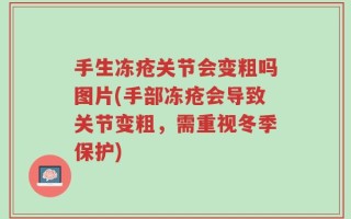 手生冻疮关节会变粗吗图片(手部冻疮会导致关节变粗，需重视冬季保护)