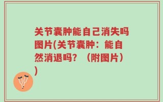 关节囊肿能自己消失吗图片(关节囊肿：能自然消退吗？（附图片）)