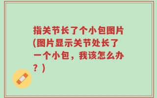 指关节长了个小包图片(图片显示关节处长了一个小包，我该怎么办？)