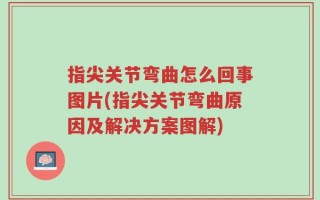 指尖关节弯曲怎么回事图片(指尖关节弯曲原因及解决方案图解)