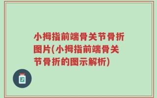 小拇指前端骨关节骨折图片(小拇指前端骨关节骨折的图示解析)