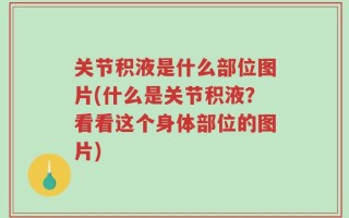 关节积液是什么部位图片(什么是关节积液？看看这个身体部位的图片)