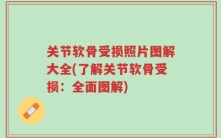 关节软骨受损照片图解大全(了解关节软骨受损：全面图解)