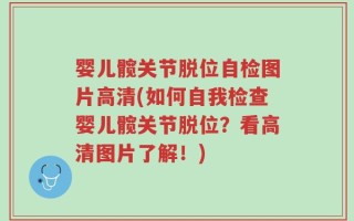 婴儿髋关节脱位自检图片高清(如何自我检查婴儿髋关节脱位？看高清图片了解！)