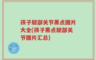 孩子腿部关节黑点图片大全(孩子黑点腿部关节图片汇总)