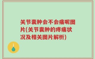 关节囊肿会不会痛呢图片(关节囊肿的疼痛状况及相关图片解析)