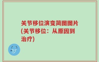 关节移位演变简图图片(关节移位：从原因到治疗)
