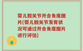 婴儿髋关节开合角度图片(婴儿髋关节发育状况可通过开合角度图片进行评估)