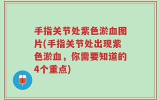 手指关节处紫色淤血图片(手指关节处出现紫色淤血，你需要知道的4个重点)