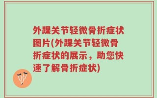 外踝关节轻微骨折症状图片(外踝关节轻微骨折症状的展示，助您快速了解骨折症状)