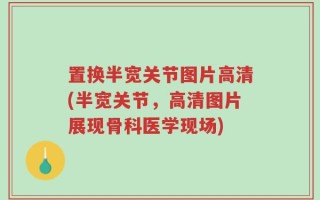 置换半宽关节图片高清(半宽关节，高清图片展现骨科医学现场)