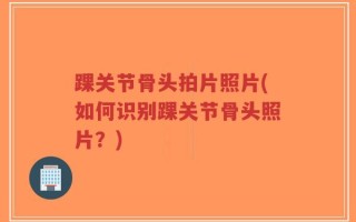 踝关节骨头拍片照片(如何识别踝关节骨头照片？)