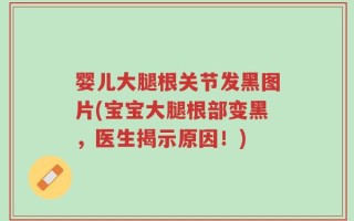 婴儿大腿根关节发黑图片(宝宝大腿根部变黑，医生揭示原因！)