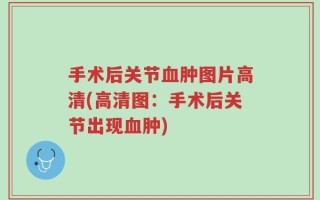 手术后关节血肿图片高清(高清图：手术后关节出现血肿)