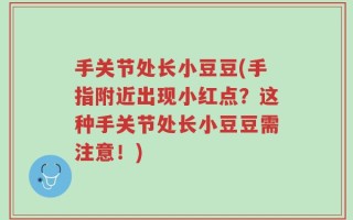 手关节处长小豆豆(手指附近出现小红点？这种手关节处长小豆豆需注意！)
