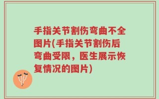 手指关节割伤弯曲不全图片(手指关节割伤后弯曲受限，医生展示恢复情况的图片)