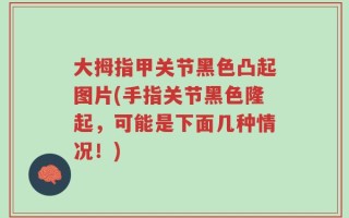 大拇指甲关节黑色凸起图片(手指关节黑色隆起，可能是下面几种情况！)