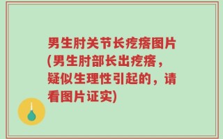 男生肘关节长疙瘩图片(男生肘部长出疙瘩，疑似生理性引起的，请看图片证实)