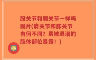 股关节和膝关节一样吗图片(肩关节和膝关节有何不同？易被混淆的肢体部位暴露！)