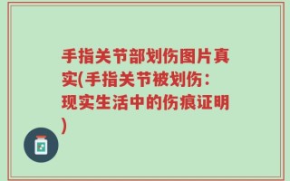 手指关节部划伤图片真实(手指关节被划伤：现实生活中的伤痕证明)
